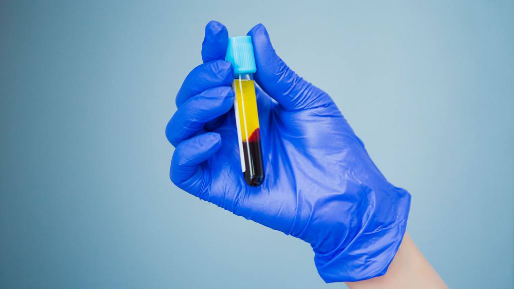Donar plasma puede salvar vidas 5 - Revista Salvador Donar plasma puede salvar vidas - Revista Salvador
